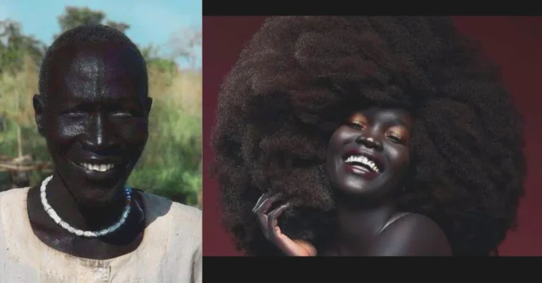 blackest person in the world